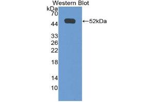 Western blot analysis of the recombinant protein. (IFNGR1 anticorps  (AA 23-253))