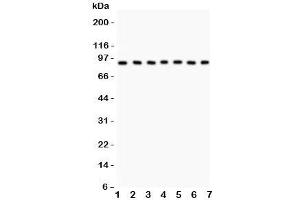 Western blot testing of MSK1 antibody and Lane 1:  human placenta;  2: rat brain;  3: (h) Jurkat;  4: (h) HeLa;  5: (h) PANC;  6: (h) A549;  7: (h) HEPG2. (MSK1 anticorps  (AA 540-665))