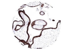 A strong inhibin alpha immunostaining is seen in the cyto and syncytiotrophoblast of the placenta of the first trimenon