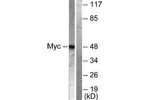Western blot analysis of extracts from HeLa cells, treated with Forskolin 40nM 30', using MYC (Ab-62) Antibody.