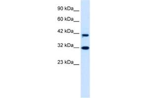 Western Blotting (WB) image for anti-D4, Zinc and Double PHD Fingers Family 1 (DPF1) antibody (ABIN2460940)