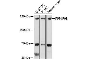 Western blot analysis of extracts of various cell lines, using PPP1R9B antibody (ABIN7269681) at 1:1000 dilution.