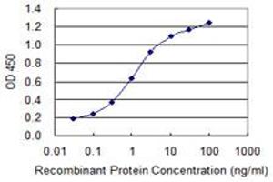 anti-Uroplakin 1B (UPK1B) (AA 131-228) antibody