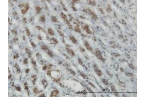 Image no. 2 for anti-RAS and EF Hand Domain Containing (RASEF) (AA 631-740) antibody (ABIN599333) (RASEF anticorps  (AA 631-740))