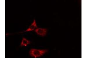 ABIN6275794 staining Hela cells by IF/ICC. (MYL7 anticorps)
