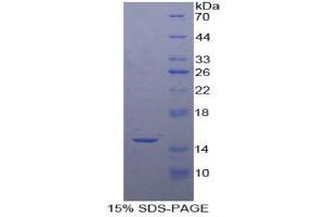 SDS-PAGE (SDS) image for Drosha, Ribonuclease Type III (DROSHA) (AA 1114-1235) protein (His tag) (ABIN1877805) (DROSHA Protein (AA 1114-1235) (His tag))