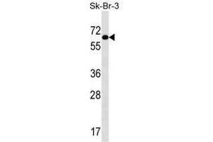 TRIP4 Antibody (Center) western blot analysis in SK-BR-3 cell line lysates (35 µg/lane). (TRIP4 anticorps  (Middle Region))