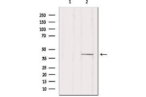 Western blot analysis of extracts from HUVEC, using ZDHHC18 Antibody.