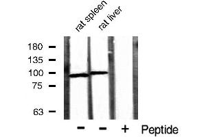 Western blot analysis of extracts of various sample,using Catenin-β antibody. (CTNNB1 anticorps  (N-Term))