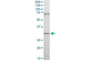 STOM polyclonal antibody (A01), Lot # 060717JCS1.