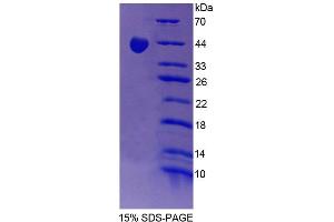 SDS-PAGE (SDS) image for Protein Phosphatase 1, Regulatory (Inhibitor) Subunit 15A (PPP1R15A) (AA 335-578) protein (His tag) (ABIN6239051)