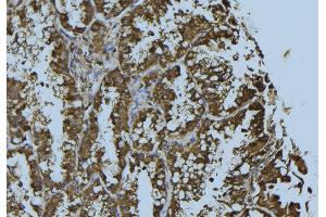 ABIN6276283 at 1/100 staining Mouse testis tissue by IHC-P. (Prohibitin anticorps  (Internal Region))