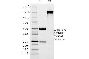 SDS-PAGE Analysis Purified pS2 Mouse Monoclonal Antibody (SPM313). (TFF1 anticorps  (AA 57-84))