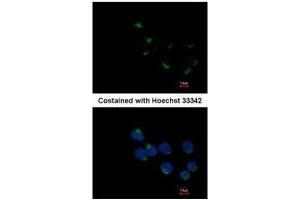 ICC/IF Image Immunofluorescence analysis of methanol-fixed A431, using GALNT6, antibody at 1:200 dilution. (GALNT6 anticorps)