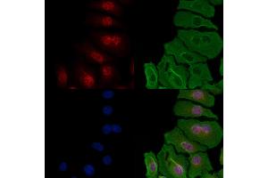 ABIN6257259 and ABIN6274296 staining Hela cells by IF/ICC. (HNRNPH1 anticorps  (Internal Region))