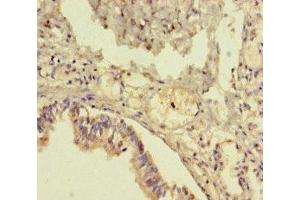 Immunohistochemistry of paraffin-embedded human lung tissue using ABIN7173257 at dilution of 1:100 (TMEM64 anticorps  (AA 40-118))
