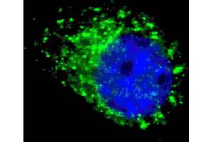 Fluorescent ige of  cells stained with G8a/b (M1LC3A/B) antibody. (MAP1LC3A/B anticorps  (cleaved))