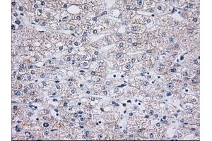 Immunohistochemical staining of paraffin-embedded Human liver tissue using anti-C15orf40 mouse monoclonal antibody. (C15orf40 anticorps)