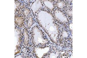 IHC analysis of SPT5/SUPT5H using anti-SPT5/SUPT5H antibody (ABIN7601985). (SUPT5H anticorps  (AA 533-1087))