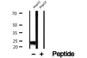 Western blot analysis of extracts of HepG2 cells, using RAB14 antibody. (RAB14 anticorps  (C-Term))