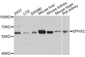 Western blot analysis of extracts of various cell lines, using EPHX2 antibody. (EPHX2 anticorps)