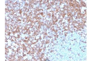 Formalin-fixed, paraffin-embedded human spleen stained with CD43 Mouse Monoclonal Antibody (SPN/3388). (CD43 anticorps)