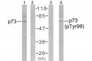 Western blot analysis of the extracts from K562 cells using p73 (Ab-99) antibody (E021075, Lane 1 and 2) and p73 (phospho-Tyr99) antibody (E011058, Lane 3 and 4). (Tumor Protein p73 anticorps)