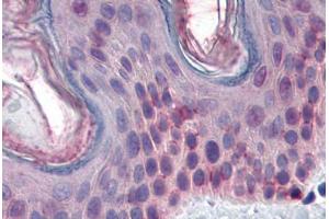 Human Skin: Formalin-Fixed, Paraffin-Embedded (FFPE)