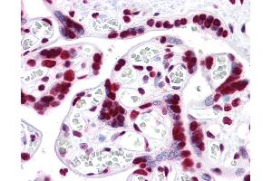 Anti-HMGB1 antibody IHC of human placenta. (HMGB1 anticorps  (AA 1-216))