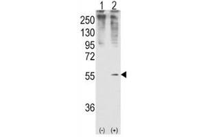 Western blot analysis of GDF11 antibody and 293 cell lysate (2 ug/lane) either nontransfected (Lane 1) or transiently transfected with the GDF11 gene (2). (GDF11 anticorps  (AA 32-61))