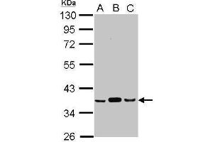 WB Image Sample (30 ug of whole cell lysate) A: A549 B: H1299 C: HCT116 10% SDS PAGE antibody diluted at 1:1000 (PDHE1-B anticorps)