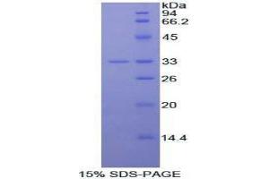 SDS-PAGE (SDS) image for Interleukin 20 Receptor alpha (IL20RA) (AA 268-538) protein (His tag) (ABIN1877908)