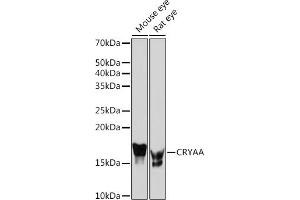 Western blot analysis of extracts of various cell lines, using CRYAA Rabbit mAb (ABIN7266527) at 1:1000 dilution. (CRYAA anticorps)