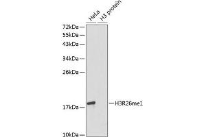 Western blot analysis of extracts of various cell lines, using MonoMethyl-Histone H3-R26 antibody (ABIN3017500, ABIN3017501, ABIN3017502 and ABIN6220121).