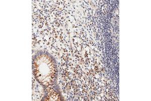 Immunohistochemical analysis of paraffin-embedded human epityphlon tissue using (ABIN1981278 and ABIN2845115) performed on the Leica® BOND RXm.