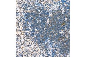 Immunohistochemistry of paraffin embedded mouse thymus using Skar (ABIN7074970) at dilution of 1:1800 (400x lens) (p46 anticorps)
