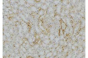 ABIN6272567 at 1/100 staining Mouse kidney tissue by IHC-P. (CYP11B2 anticorps  (Internal Region))