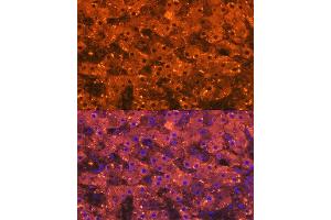 Immunofluorescence analysis of human liver using Alpha-2-Macroglobulin (Alpha-2-Macroglobulin (M)) Rabbit mAb (ABIN7265558) at dilution of 1:100 (40x lens).