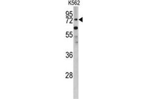 Western blot analysis of PLZF antibody (C-term) in K562 cell line lysates (35ug/lane). (ZBTB16 anticorps  (C-Term))