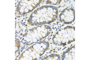Immunohistochemistry of paraffin-embedded human colon using GNE antibody at dilution of 1:100 (x40 lens). (GNE anticorps)