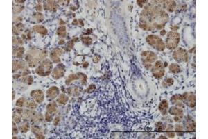 Image no. 1 for anti-Homeodomain Interacting Protein Kinase 1 (HIPK1) (AA 330-430) antibody (ABIN466275) (HIPK1 anticorps  (AA 330-430))