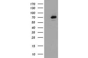Western Blotting (WB) image for anti-SAM Domain and HD Domain 1 (SAMHD1) antibody (ABIN1500801) (SAMHD1 anticorps)