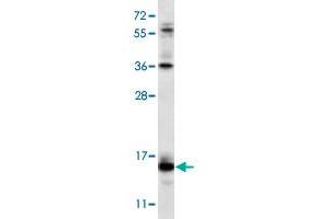 Western blot analysis of NCI-H460 cell lysate (35 ug/lane) with RCAN2 polyclonal antibody . (RCAN2 anticorps  (N-Term))