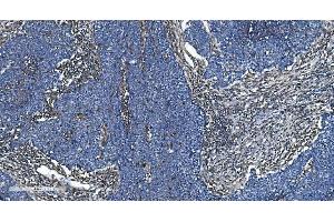 IHC analysis of GNG2 using anti-GNG2 antibody (ABIN7600505).