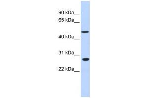 Western Blotting (WB) image for anti-Zinc Finger Protein 556 (ZNF556) antibody (ABIN2458203) (ZNF556 anticorps)