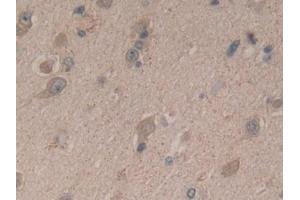 Detection of SDF2 in Human Brain Tissue using Polyclonal Antibody to Stromal Cell Derived Factor 2 (SDF2)