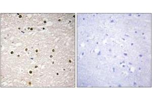 Immunohistochemistry analysis of paraffin-embedded human brain tissue, using p73 Antibody. (Tumor Protein p73 anticorps  (AA 271-320))