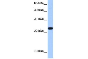 WB Suggested Anti-C19orf24 Antibody Titration:  0. (C19orf24 anticorps  (N-Term))