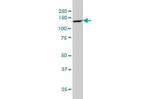 PCDH8 monoclonal antibody (M01), clone 6A8 Western Blot analysis of PCDH8 expression in COLO 320 HSR .