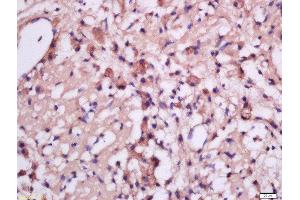 Formalin-fixed and paraffin embedded rat brain tissue labeled with Anti-MSRB2 Polyclonal Antibody, Unconjugated  at 1:300 followed by conjugation to the secondary antibody and DAB staining